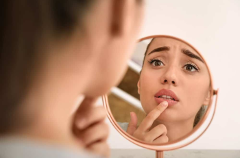 Σκασμένα χείλη: 5 Tips αντιμετώπισης - LadiesWorld.gr